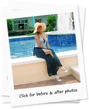 before & after weight loss photos & stories